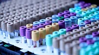 Blood Samples